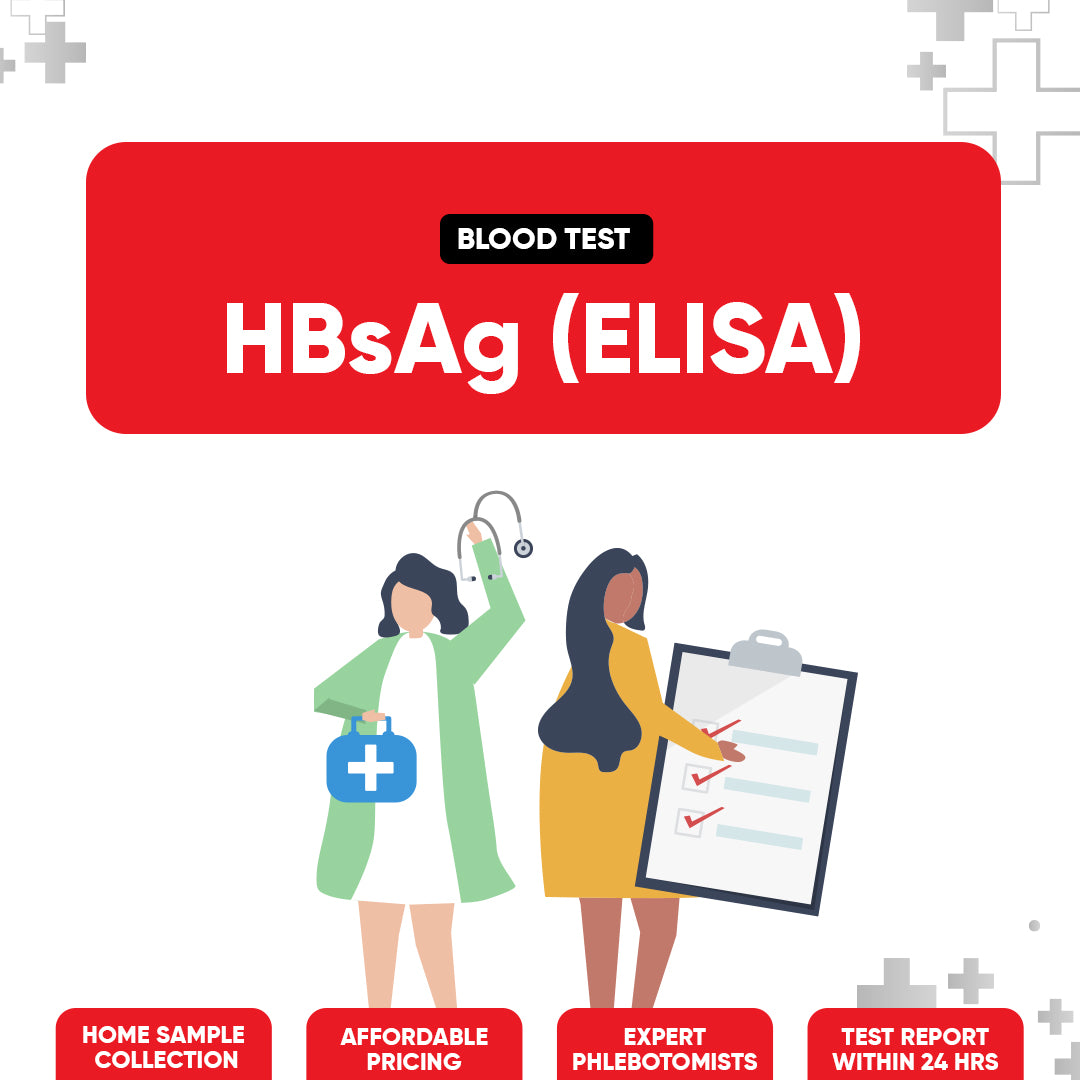 HBsAg ELISA Test