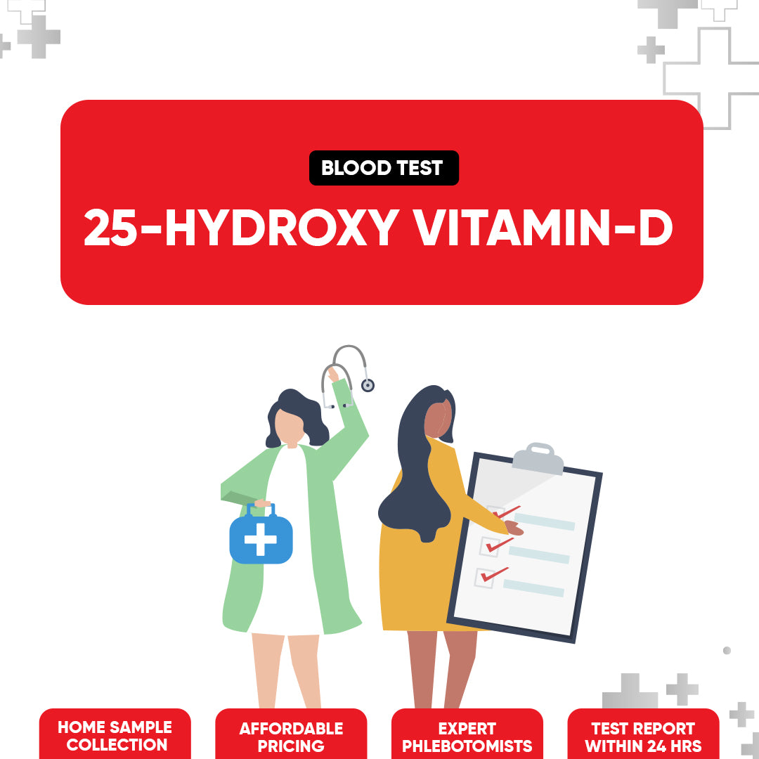 25−Hydroxy Vitamin−D Test