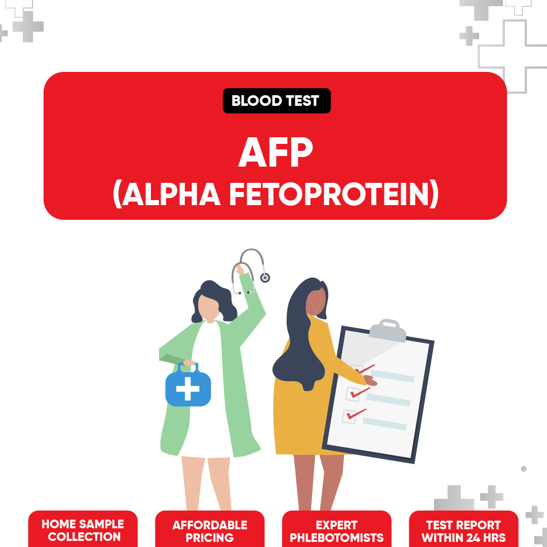 AFP (Alpha Fetoprotein) Test