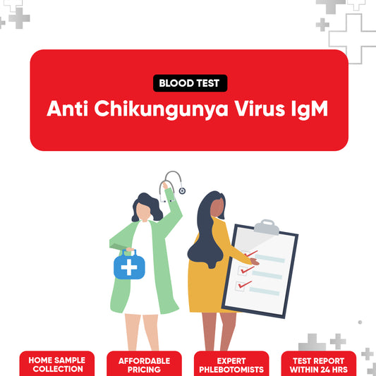 Anti Chikungunya Virus IgM Test