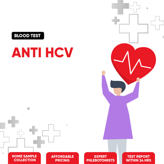 Anti HCV Test