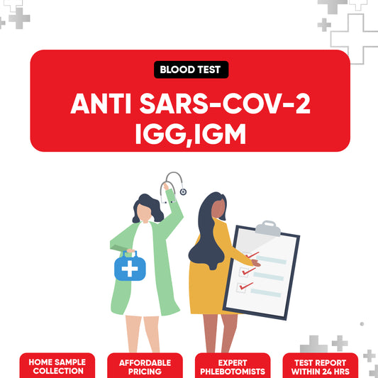 Anti SARS−CoV−2 IgG,IgM Test