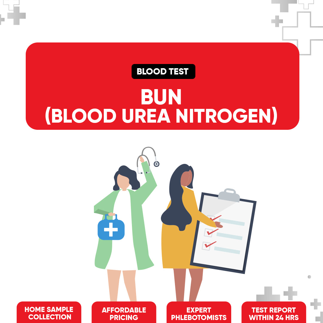 BUN (Blood Urea Nitrogen) Test