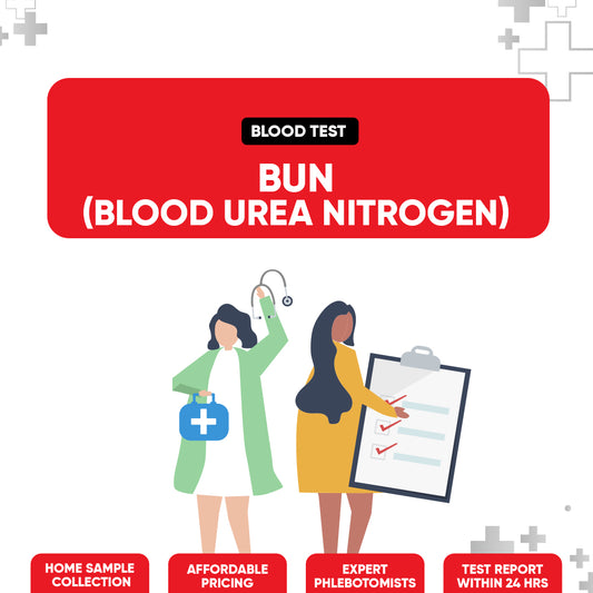 BUN (Blood Urea Nitrogen) Test