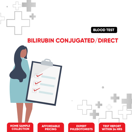 Bilirubin Conjugated/Direct Test