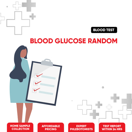 Blood Glucose Random Test