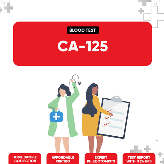 CA 125 Test