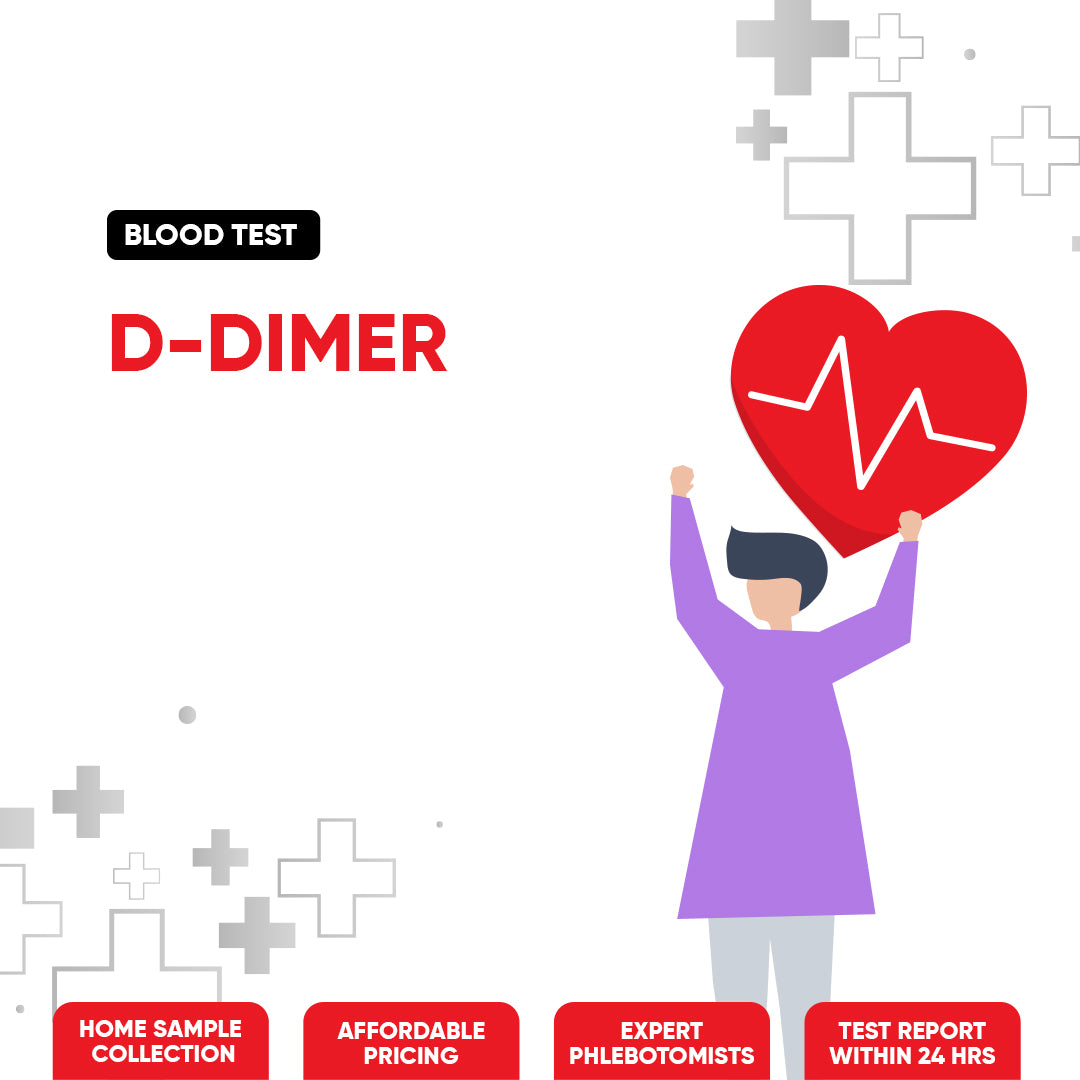 D−Dimer Test