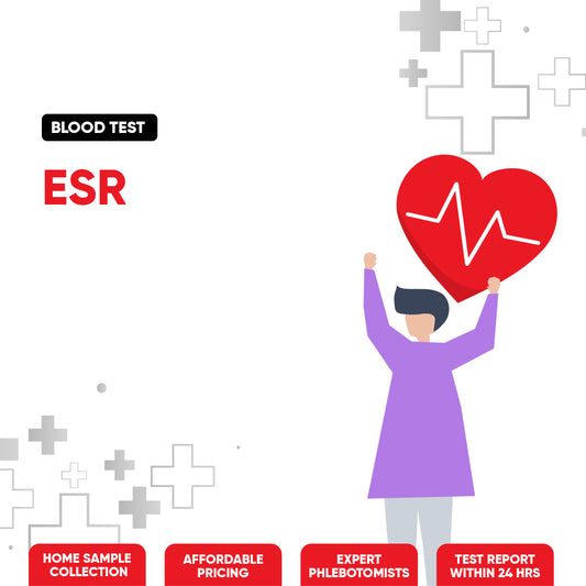 ESR Test