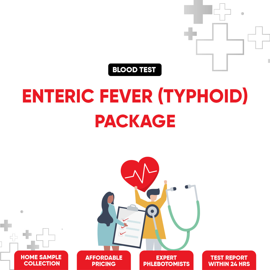 Enteric Fever (Typhoid) Test