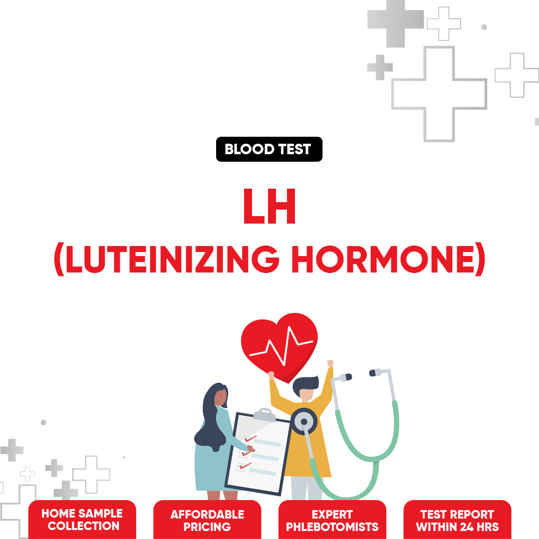 LH (Luteinizing hormone) Test Find My Doctor