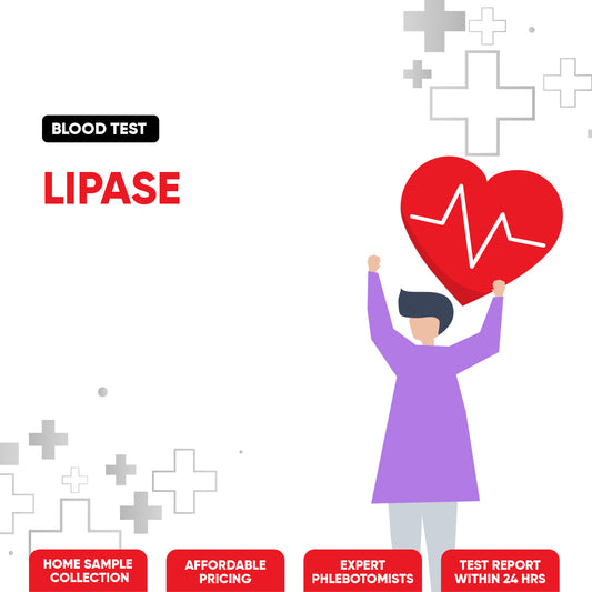 Lipase Test