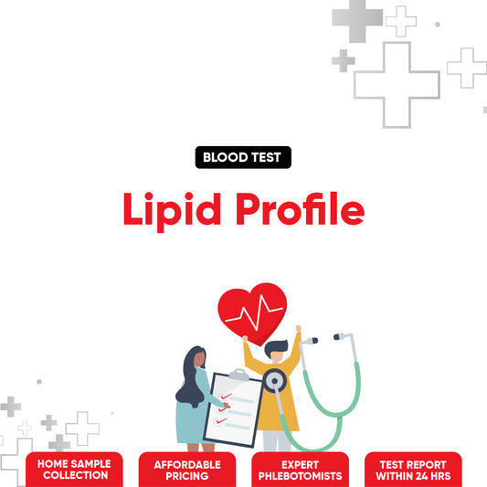 Lipid Profile Test