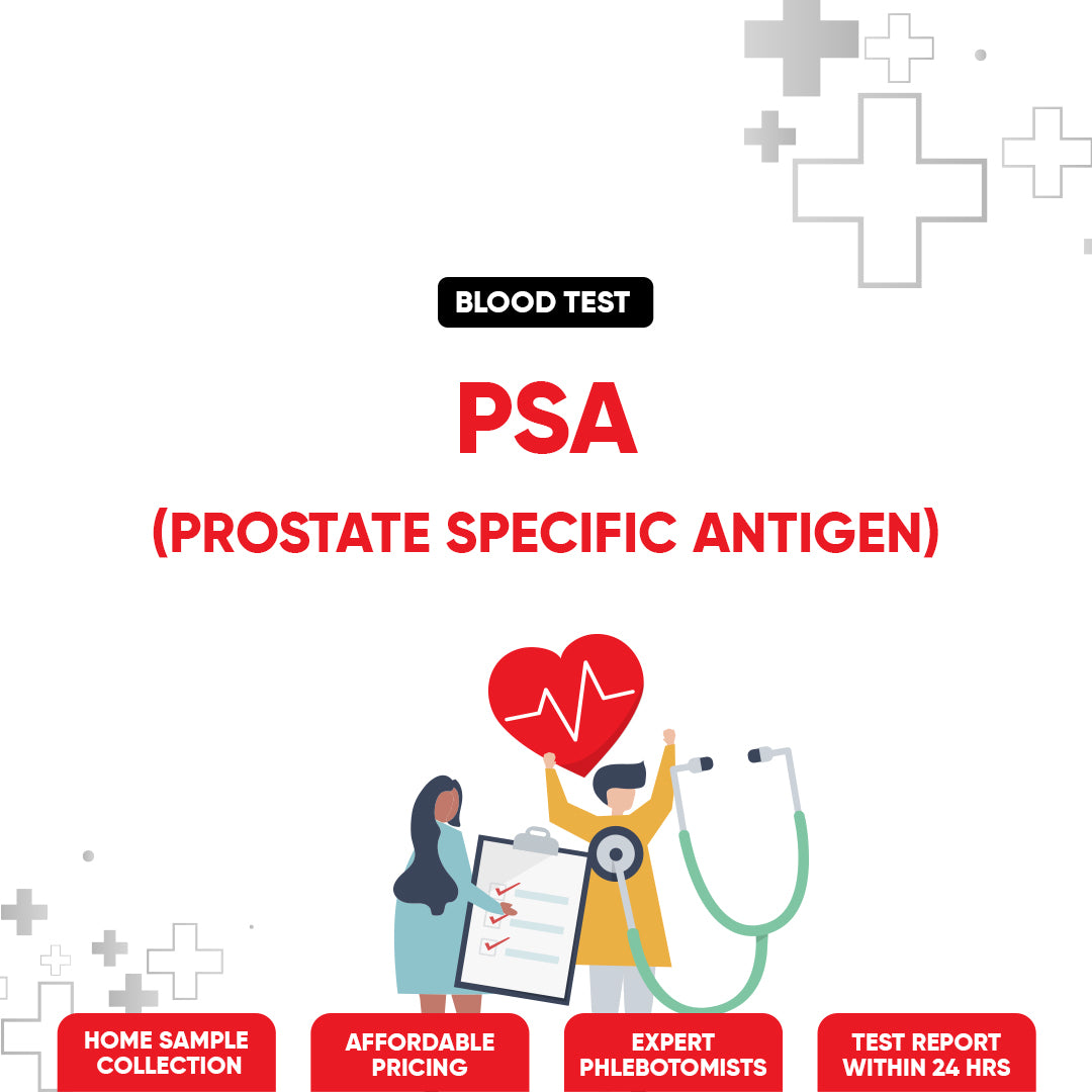 PSA (Prostate Specific Antigen) Test – Find My Doctor