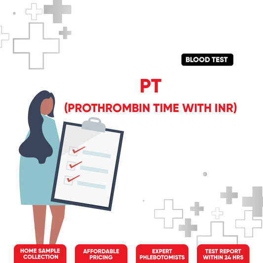 PT (Prothrombin Time) with INR Test