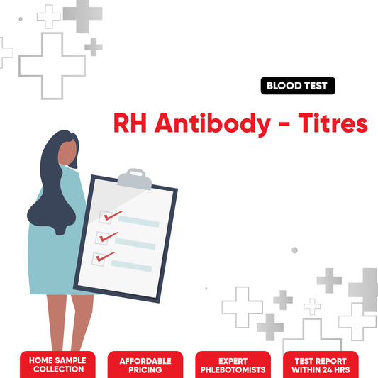 RH Antibody-Titres Test