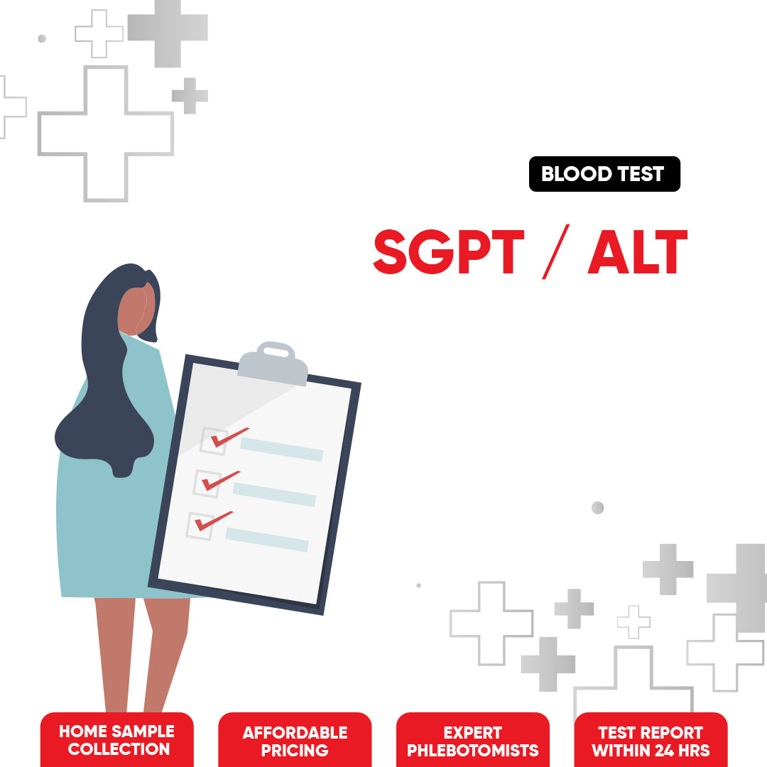 SGPT / ALT Test