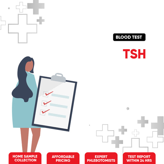 TSH Test