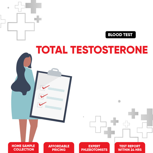 Total Testosterone Test