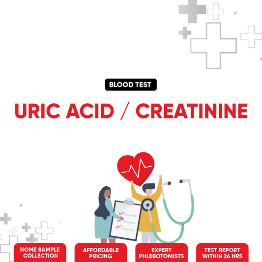 Uric Acid/Creatinine Test