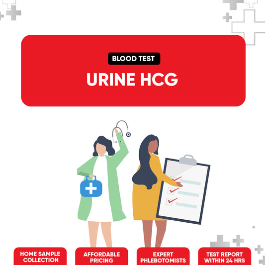 Urine HCG Test