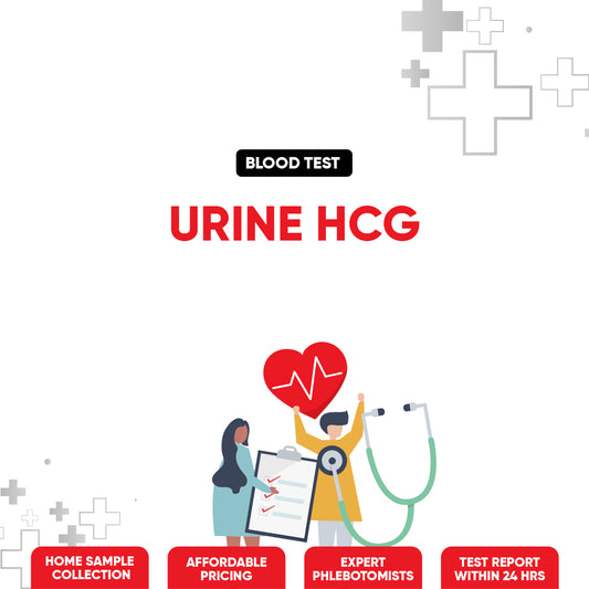 Urine hCG Test