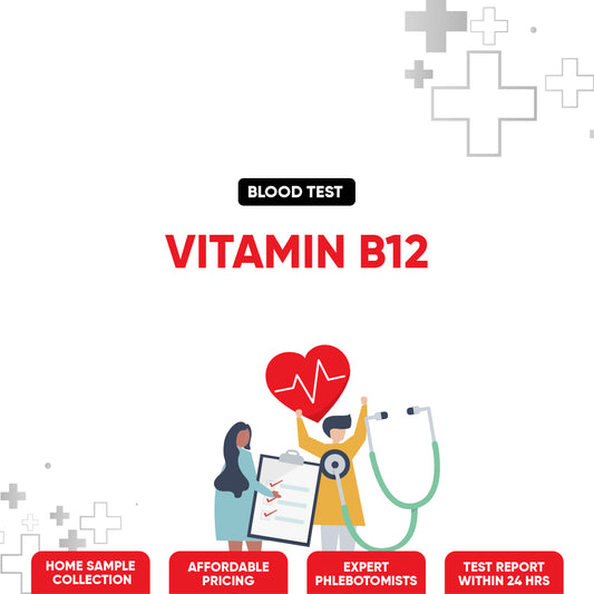 Vitamin B12 Test